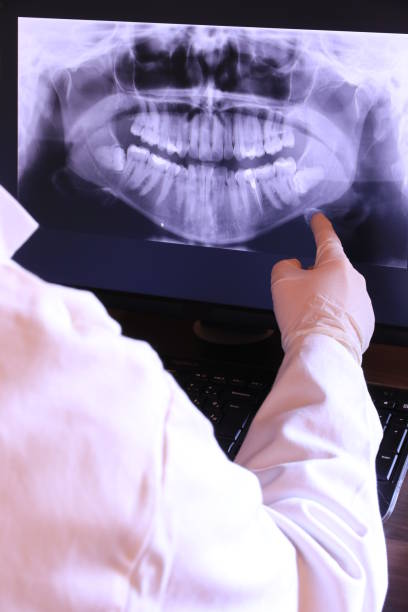 Best Emergency Wisdom Teeth Removal in Golden Beach, MD