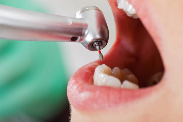 Best Weekend Emergency Dentist in Golden Beach, MD